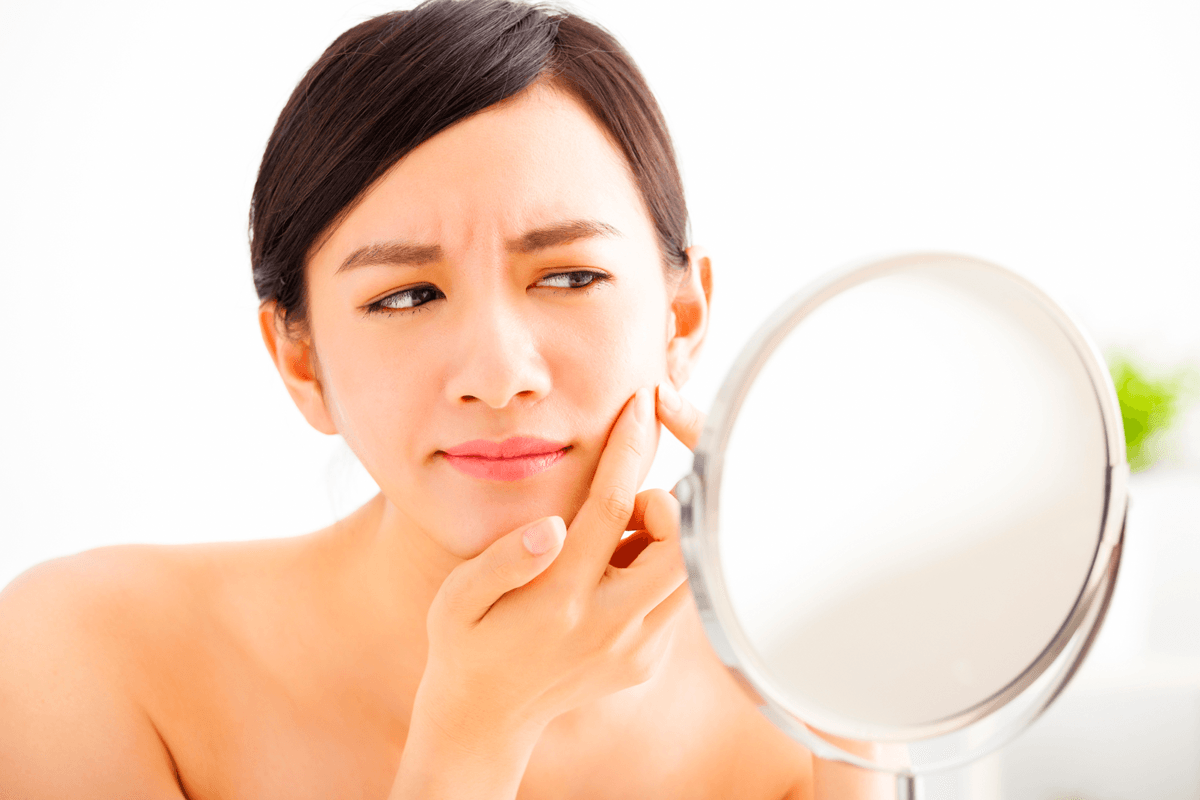 acne-rosto-cuidados
