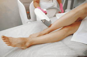 depilacao a laser